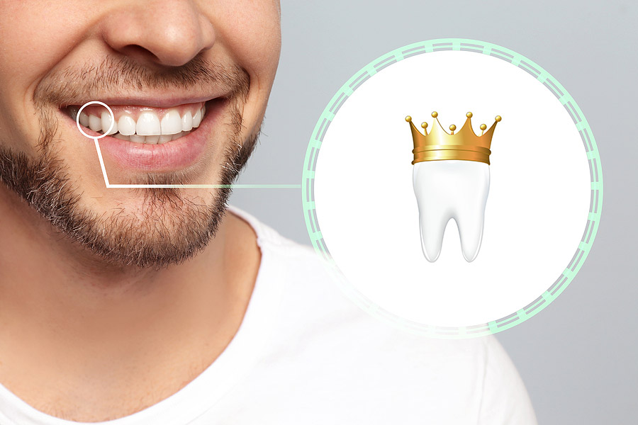 crowns